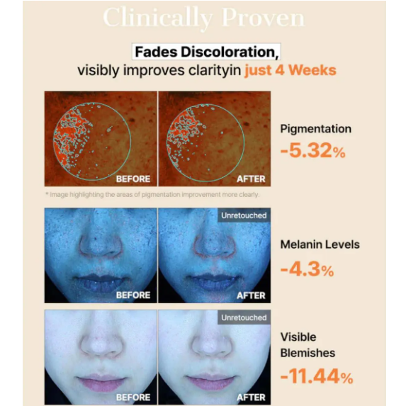 COSRX - The Alpha-Arbutin Discoloration Care Hydrogel Mask with Niacinamide + NAG + Collagen, 1 Sheet (Pack of 3)