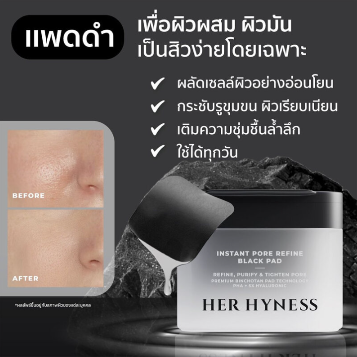 Her Hyness - Instant Pore Refine Black Pads with PHA and 5X Hyaluronic (80 Sheets)