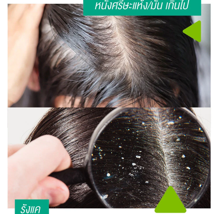 Smooth E - Anti Hair Loss Serum Spray 20ml.