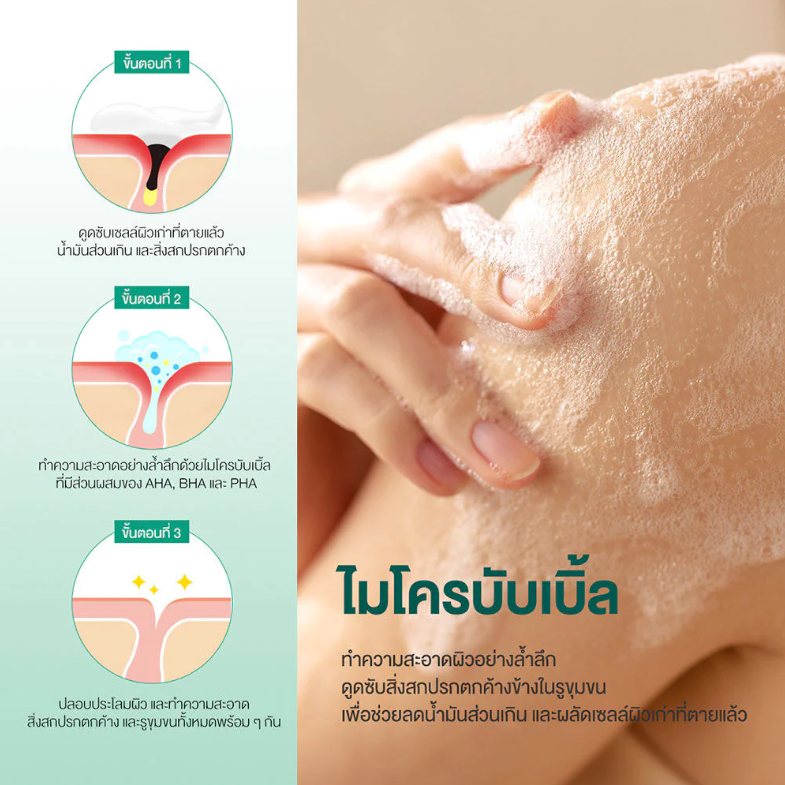 SOME BY MI - AHA-BHA-PHA 30 Days Miracle Acne Clear Body Cleanser 400g.