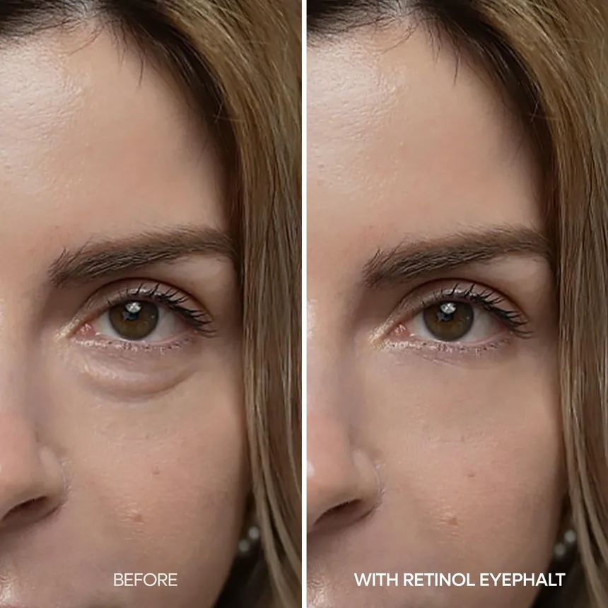 Dr.Melaxin - Eyephalt Retinol Eyebag Cream 10ml.