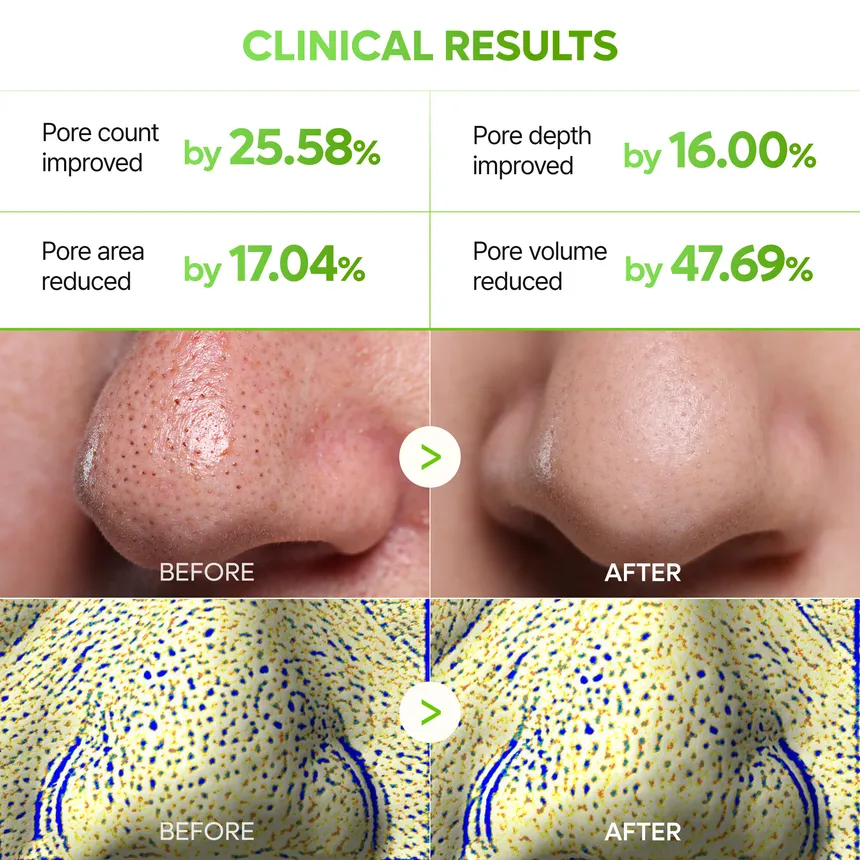 Dr.Melaxin - Cactox 3-Step Nose Pore Pack (3 Sheets)