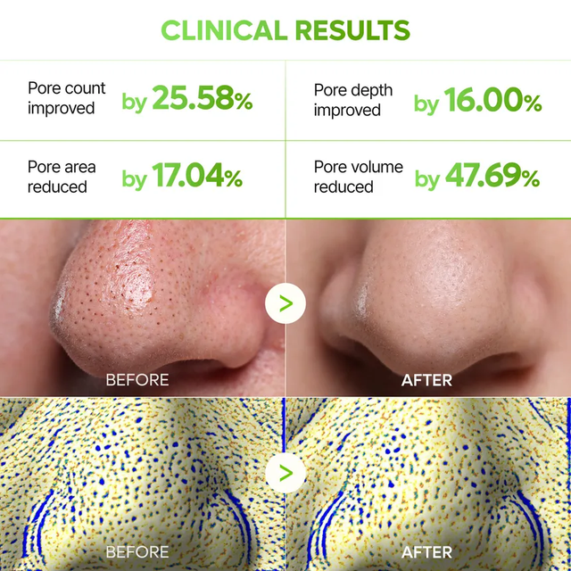 Dr.Melaxin - Cactox 3-Step Nose Pore Pack (3 Sheets)