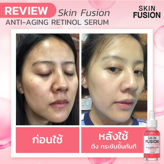 Skin Fusion - Anti-Aging Retinol Serum 30ml.