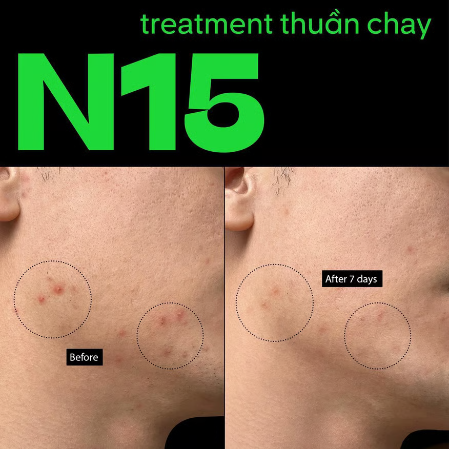 Cocoon Vietnam - Winter Melon Serum N15 (Tinh Chất Bí Đao N15) with Winter Melon Extract, 15% Niacinamide, 4% NAG, Neem Oil & Broad Spectrum Antioxidants 70ml.