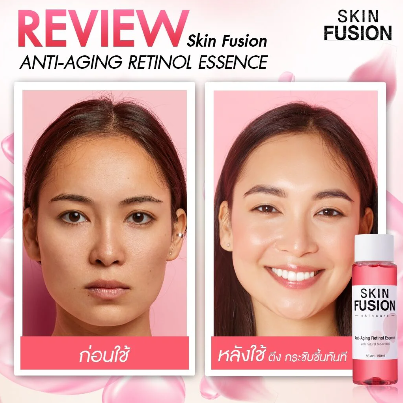 Skin Fusion - Anti-Aging Retinol Essence 150ml.