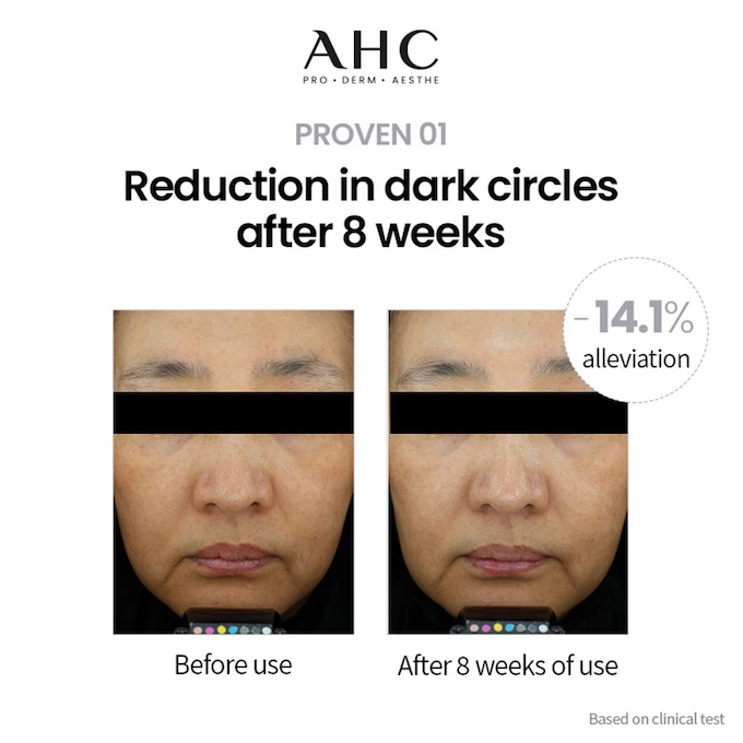 AHC - Pro Shot Gluta-Ctivation Bright 3 Capsule-Infused Eye Cream For Face 30ml.