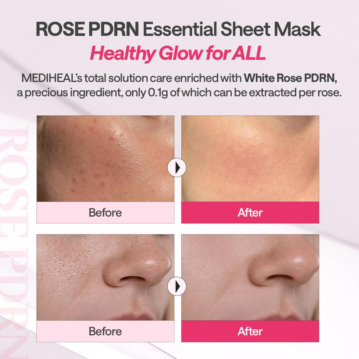 Mediheal - Rose PDRN Essential Mask Healthy Glow 24ml. (Pack of 4)