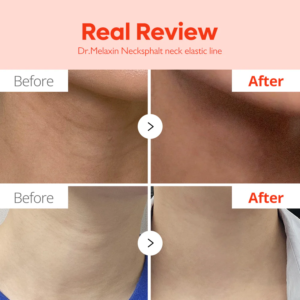 Dr.Melaxin - Necksphalt ECM Neck Barrier Ampoule (10 pieces)