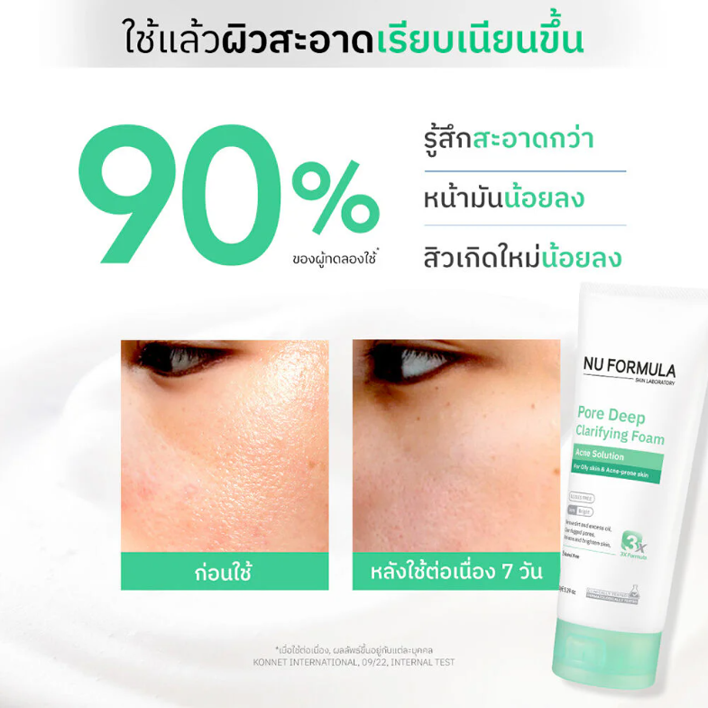Nu Formula - Pore Deep Clarifying Foam Acne Solution 150g.
