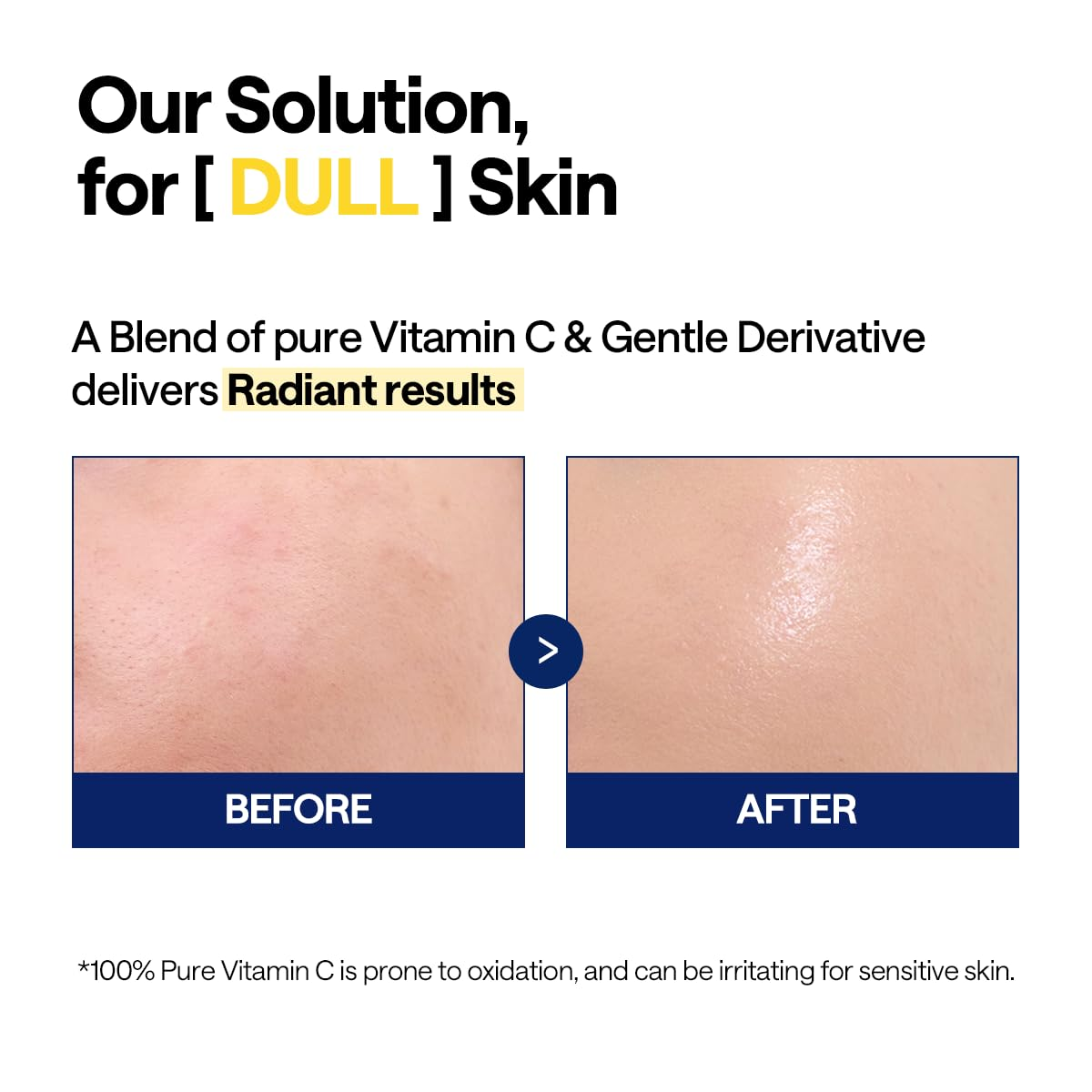 Mediheal - Vitamin C Brightening Serum with Niacinamide 40ml.