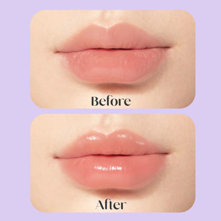 Baby Bright - Hya Glow Lip Balm 2.6g.