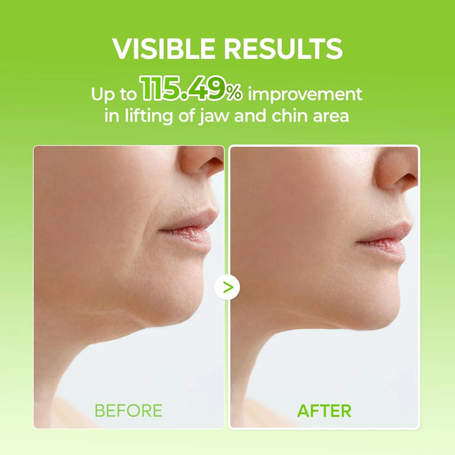 Dr.Melaxin - Cactox Cooling V-Up Mask, De-Puffing & Contour-Fit Chin Mask 9.3g. (4 Sheets)