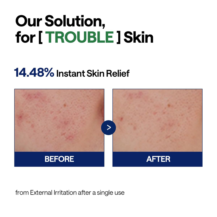 Mediheal - Teatree Calming Hydra Serum with Niacinamide 40ml.