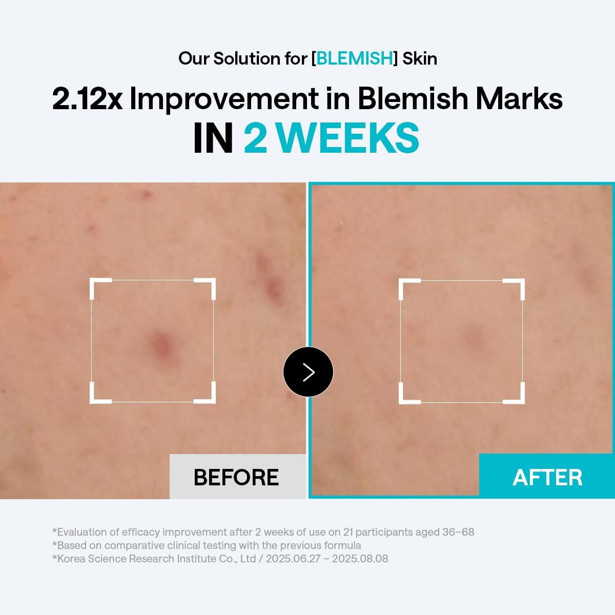 Mediheal - Bundle: 1x Madecassoside Blemish Pad 170ml. (100 Pads) + 1x Labocare Pantenolips Healssence 10ml.