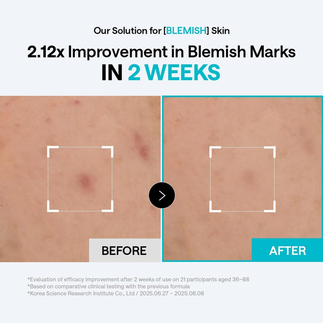 Mediheal - Bundle: 1x Madecassoside Blemish Pad 170ml. (100 Pads) + 1x Pantenolips Essence Berrypink 10ml.