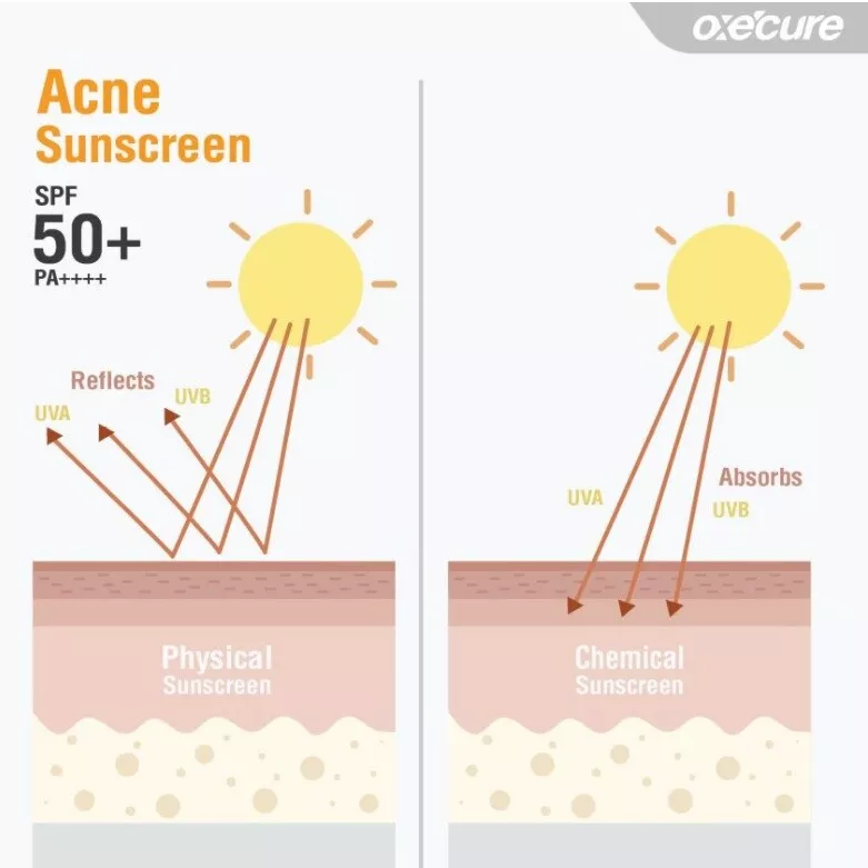 Oxe Cure - Acne Sunscreen 30g.