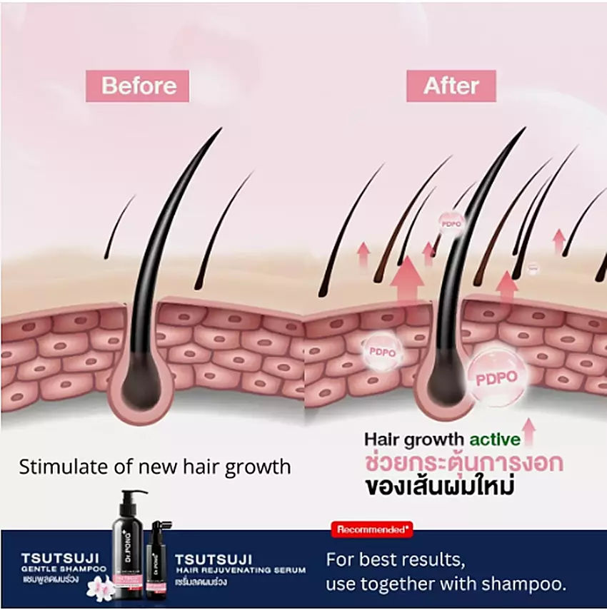 Dr.PONG - Tsutsuji Hair Rejuvenating Serum 30ml.