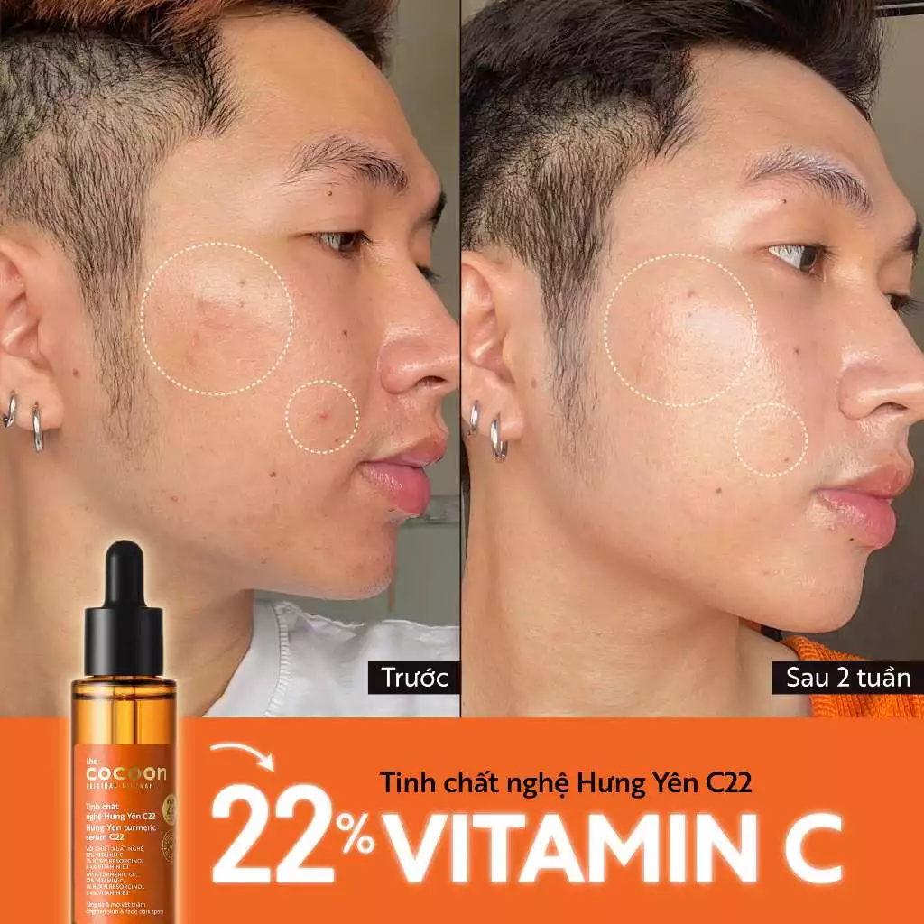 Cocoon Vietnam - Hung Yen Turmeric Serum x2.2 (Tinh Chất Nghệ Hưng Yên) with Turmeric Extract & Vitamin C 30ml.