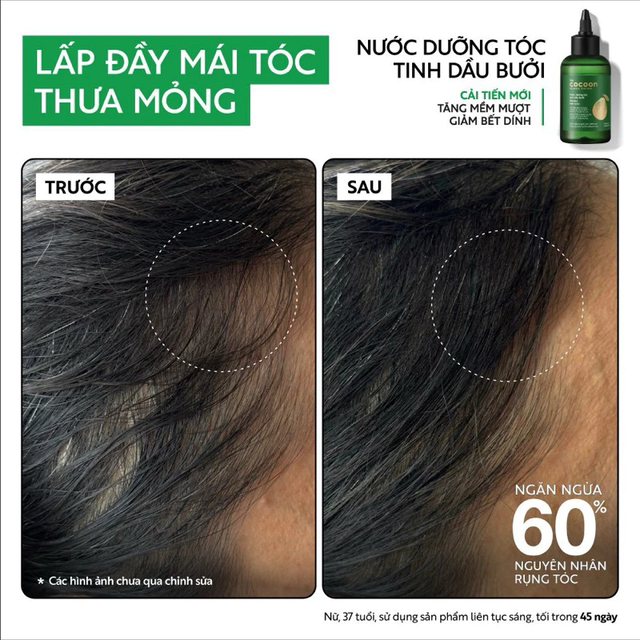 Cocoon Vietnam - Pomelo Hair Tonic (Nước Dưỡng Tóc Tinh Dầu Bưởi) with Pomelo Oil, Vitamin B5, Xylishine™, Baicapil™ & Bisabolol, Alcohol-Free 310ml.