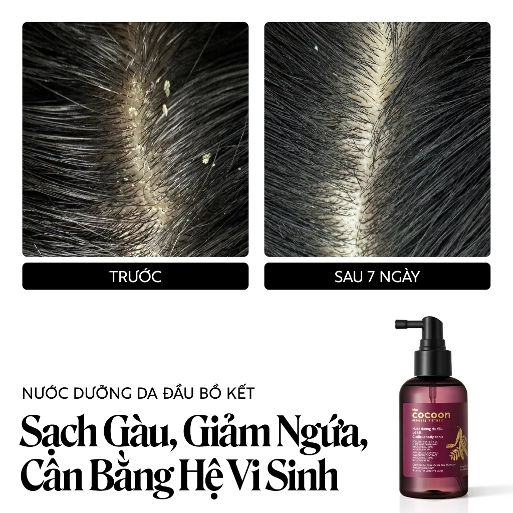 Cocoon Vietnam - Gleditsia Scalp Tonic (Nước Dưỡng Da Đầu Bồ Kết) with Gleditsia Extract, Passionfruit Extract, 0.5% Crinipan PMC, & Fluidipure 8G, Alcohol-Free 140ml.