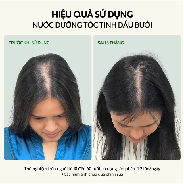 Cocoon Vietnam - Pomelo Hair Tonic (Nước Dưỡng Tóc Tinh Dầu Bưởi) with Pomelo Essential Oil, Vitamin B5, Xylishine™, Baicapil™ & Bisabolol, Alcohol-Free 140ml.