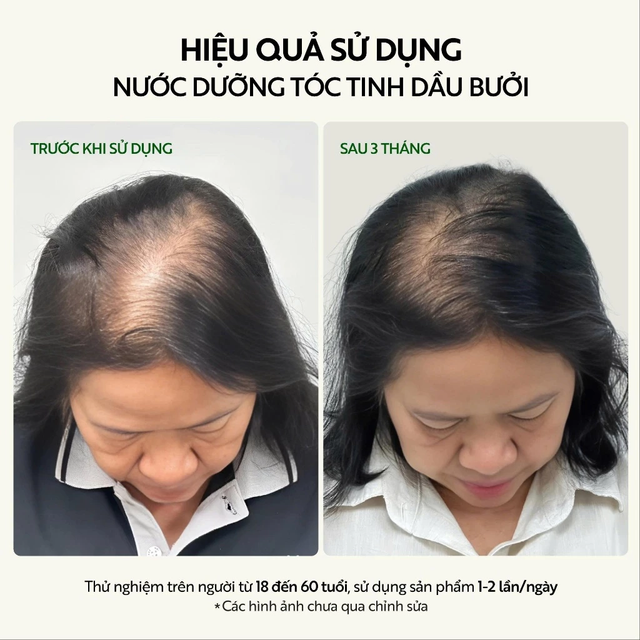 Cocoon Vietnam - Pomelo Hair Tonic (Nước Dưỡng Tóc Tinh Dầu Bưởi) with Pomelo Essential Oil, Vitamin B5, Xylishine™, Baicapil™ & Bisabolol, Alcohol-Free 140ml.